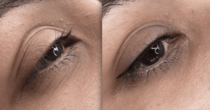 eyeliner tattoo before and after