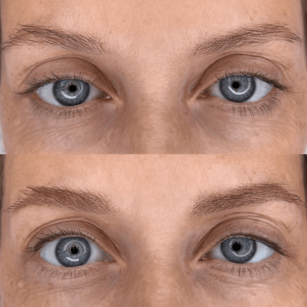 tattoo eyeliner before and after